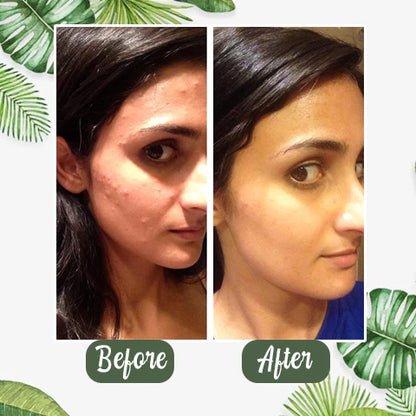 Buy 1 GET 1 FREE! Dystar Green Tea Deep Cleanse Mask Stick + Free Shipping