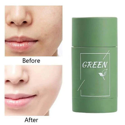 Buy 1 GET 1 FREE! Dystar Green Tea Deep Cleanse Mask Stick + Free Shipping