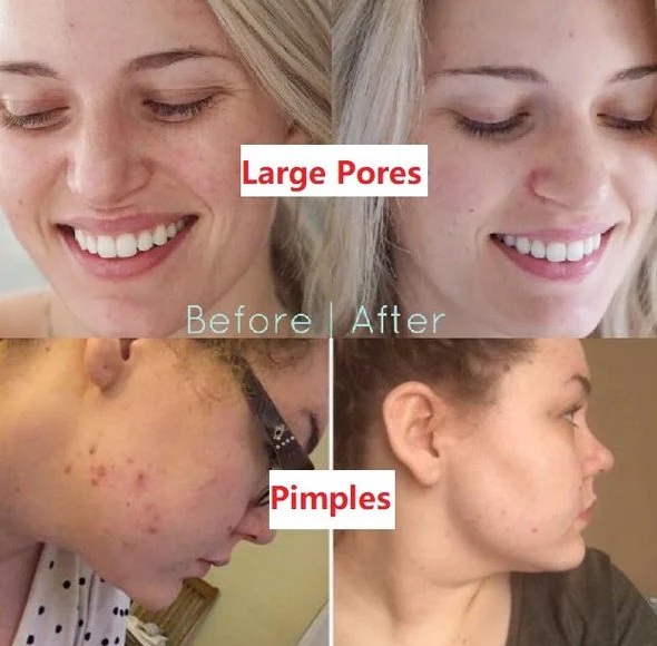 Buy 1 GET 1 FREE! Dystar Green Tea Deep Cleanse Mask Stick + Free Shipping