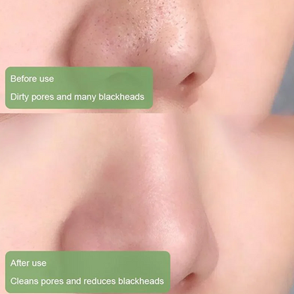 Buy 1 GET 1 FREE! Dystar Green Tea Deep Cleanse Mask Stick + Free Shipping